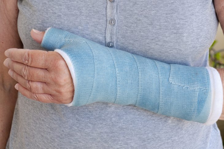 Broken Wrist Care at Panorama Ortho