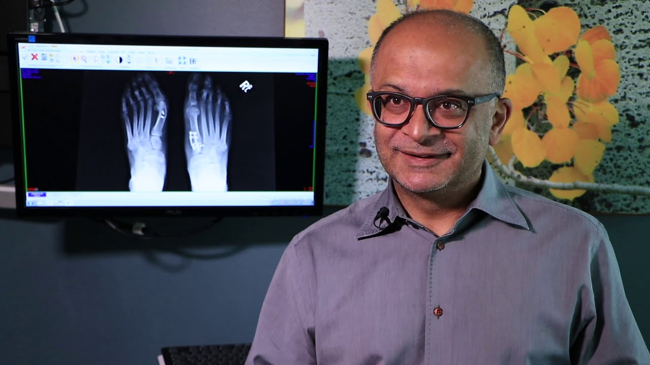 Foot &Amp; Ankle 5 Dr desai explains lapiplasty a new way to correct bunions