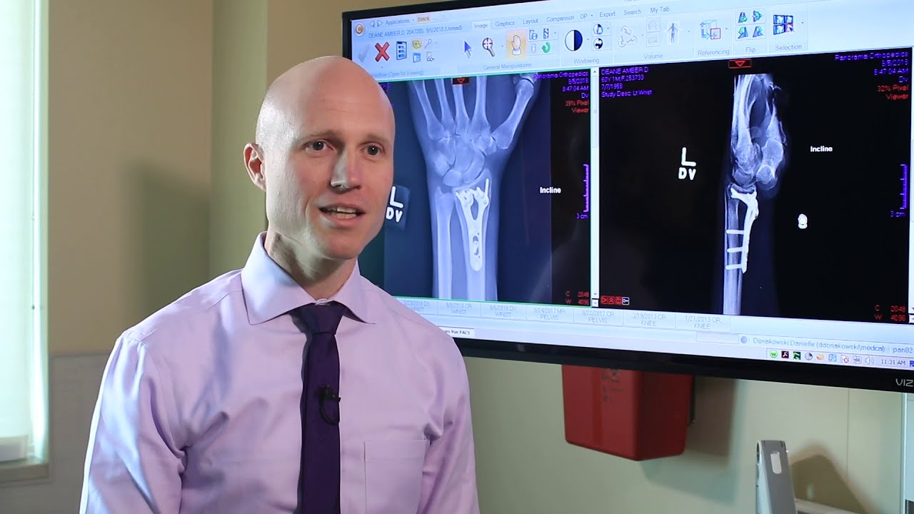 Hand &Amp; Wrist 6 Learning about a broken wrist and understanding the recovery