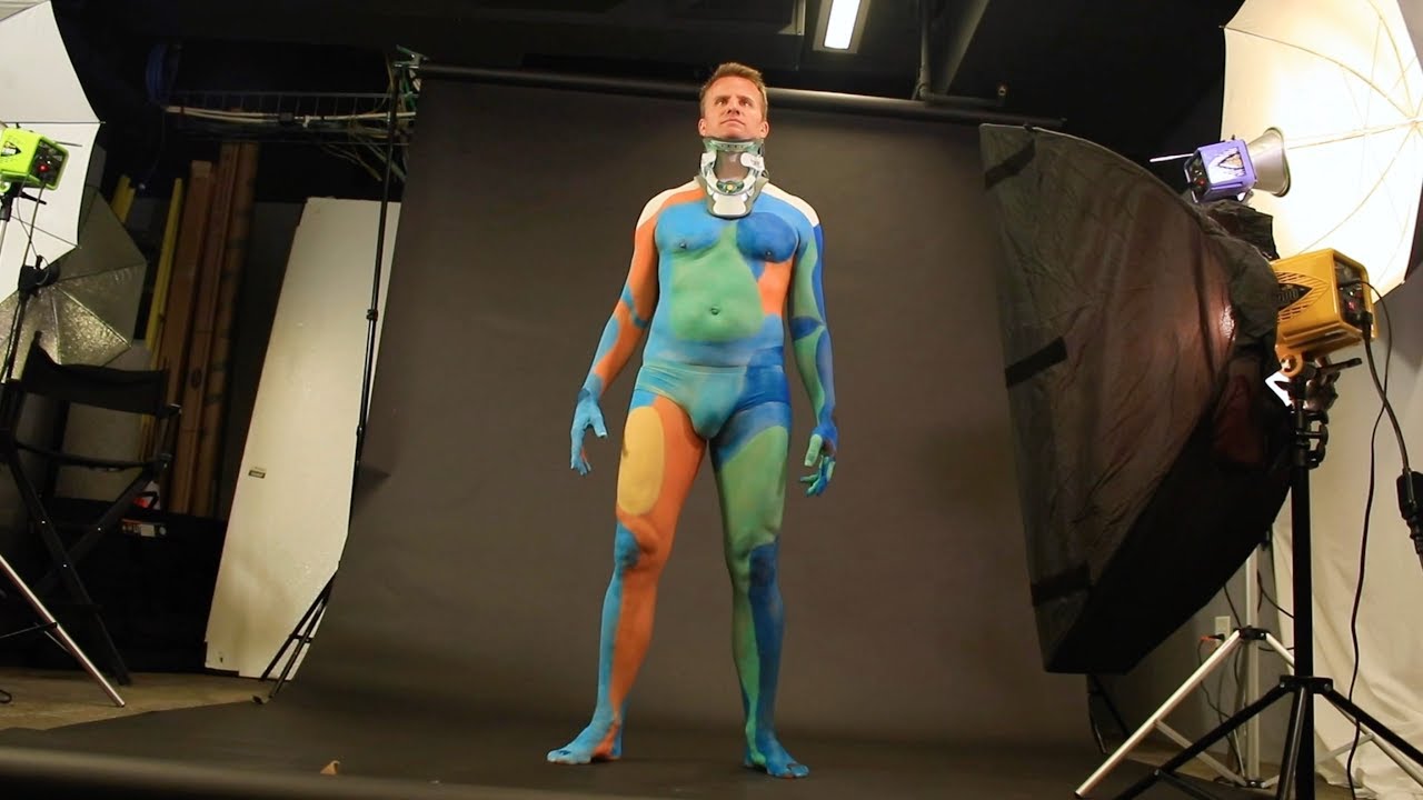 Orthopedic Trauma 14 Paralyzed from a mountain biking accident matts story of miraculous recovery